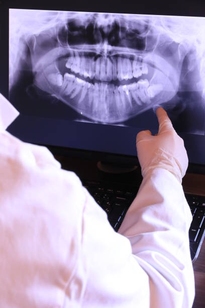 Best Knocked-Out Tooth (Avulsed Tooth) Treatment in Crimora, VA
